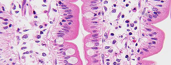 Pathologie cellen
